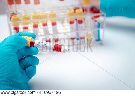 Test Tubes Containing Blood And Plasma Extracted From The Blood Of People Who Had Been Ill With Coro