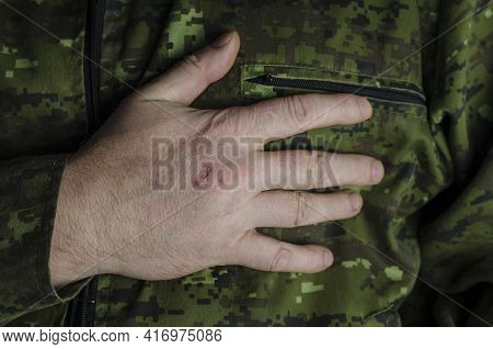 The Officer Puts His Hand In His Chest. The Right Hand Of A Man With Damaged Skin Rests On His Heart