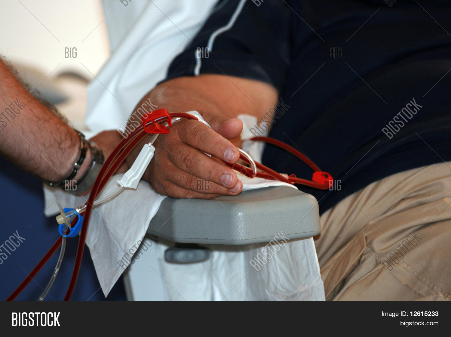 Arm Dialysis Shunt Image & Photo (Free Trial) Bigstock