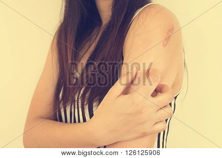 Itching In A Woman. Vintage closeup portrait.