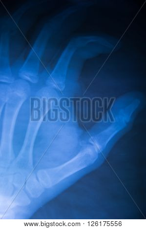 X-ray asian skull and blank area at left side