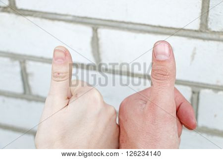 two hands touching show thumbs up success means
** Note: Visible grain at 100%, best at smaller sizes