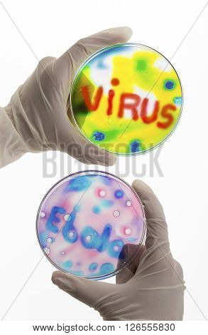hand of a searcher with petri dish with ebola virus