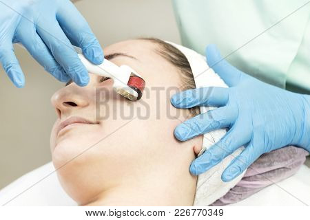 The Woman Undergoes The Procedure Of Medical Micro Needle Therapy With A Modern Medical Instrument D