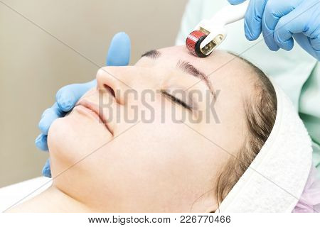 The Woman Undergoes The Procedure Of Medical Micro Needle Therapy With A Modern Medical Instrument D
