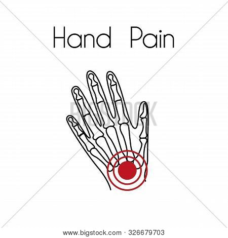 Hand Pain Linear Icon. Vector Abstract Minimal Illustration Of A Hand With Red Spot On It. Design Te