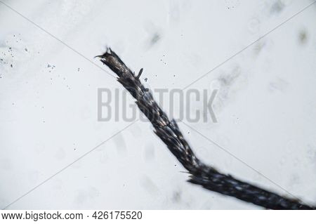 Ephestia Elutella, Leg Of Grain Moth With Scales Macro Close Up Under The Light Microscope, Magnific