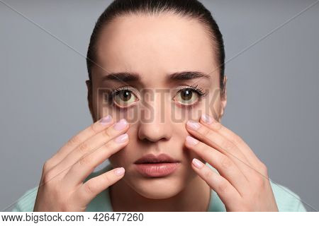 Woman Checking Her Health Condition On Grey Background. Yellow Eyes As Symptom Of Problems With Live