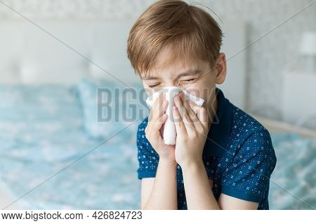 Caucasian Boy Suffers From A Runny Nose And Allergic Reactions To Pollen. Colds Viral Diseases In Ch