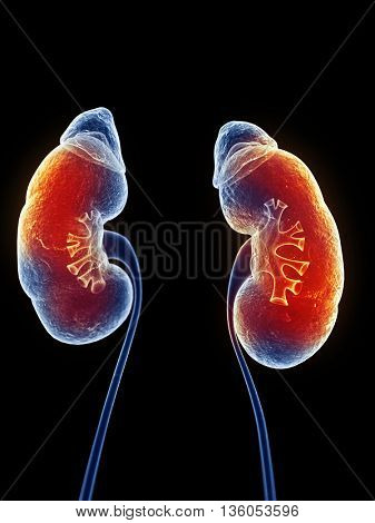 3d rendered, medically accurate illustration of inflamed kidneys