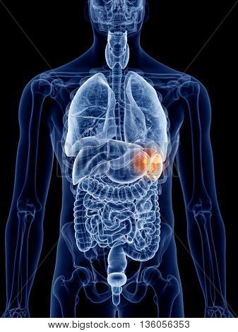 3d rendered, medically accurate illustration of spleen cancer