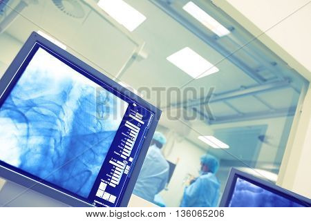 Monioring procedure in the cathlab control room.