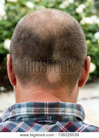 an apprentice to a barber is a mishap happened