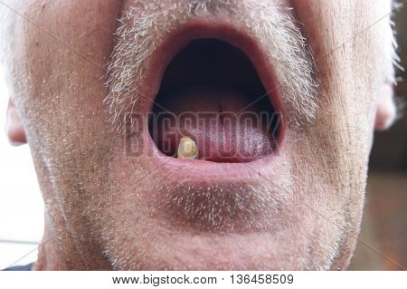 The Mouth of the person with sick teeth.Open mouth without teeth
