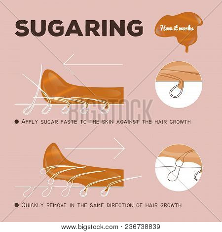 Instruction Of Sugaring Epilation. How It Works. Sugar Paste