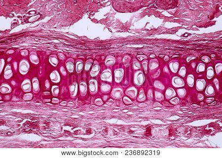 Cross Section Human Cartilage Bone Under Microscope View For Education Histology. Human Tissue