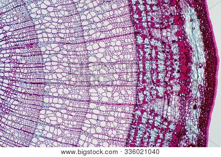 Cross Section - Xylem Is A Type Of Tissue In Vascular Plants That Transports Water And Some Nutrient