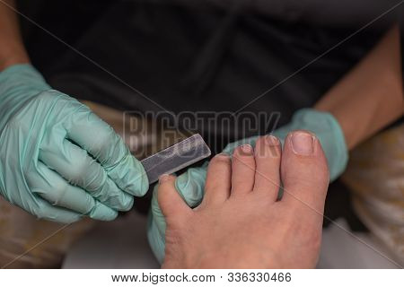 Podiatrist Treating Toenail. Podology Treatment. Podology Of Applying Gel Polish To Remove Onycholys