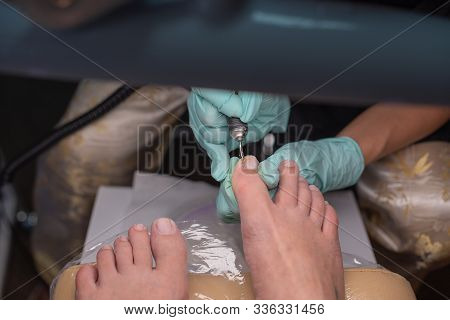 Podiatrist Treating Toenail. Podology Treatment. Podology Of Applying Gel Polish To Remove Onycholys