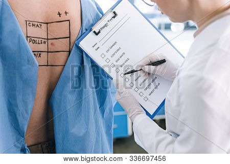 Cropped View Of Allergist Holding Pen Near Checklist While Holding Clipboard Near Patient