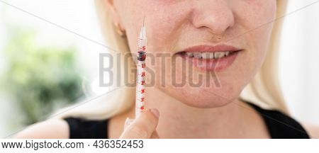 Bio-revitalization Of The Face And Neck. The Fight Against The Signs Of Aging And Skin Pigmentation.