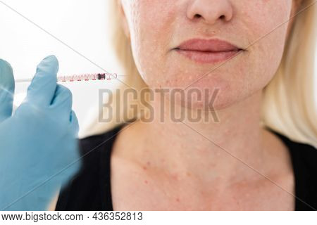Bio-revitalization Of The Face And Neck. The Fight Against The Signs Of Aging And Skin Pigmentation.