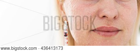 Mesotherapy In The Neck And Chest-neckline. Traces Of Hyaluronic Acid Injections. Light Background
