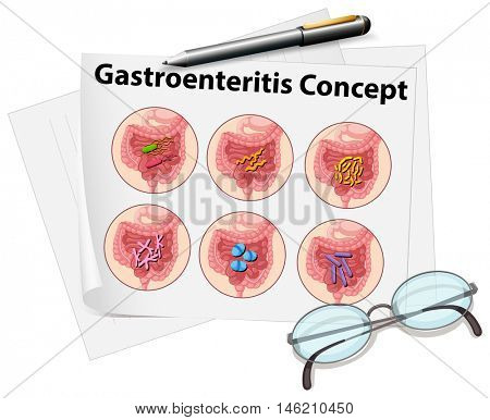 Gastroenteritis concept on paper illustration