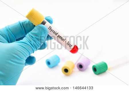 Test tube with blood sample for thyroid panel test