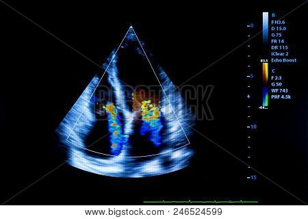 Colourful Image Of Modern Ultrasound Monitor. Ultrasonography Machine. High Technology Medical And H