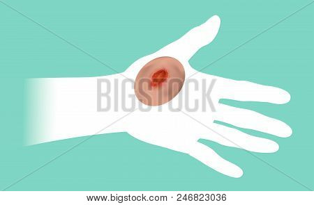 The Hands That Get Hurt By The Wound. Illustration Info Graphic.