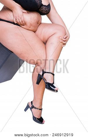 Overweight Woman With Fat Thighs, Obesity Female Legs Isolated On White Background