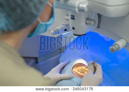 A Close-up Of The Hands Of An Ophthalmologist Surgeon Looking Through A Microscope Using Microsurgic