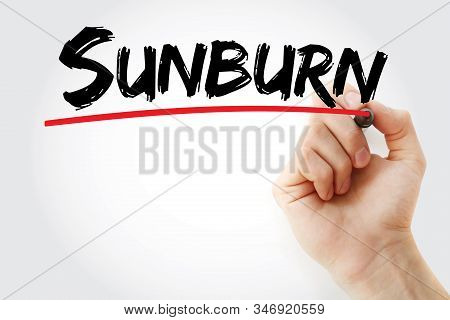 Sunburn - Text With Marker, Concept Background