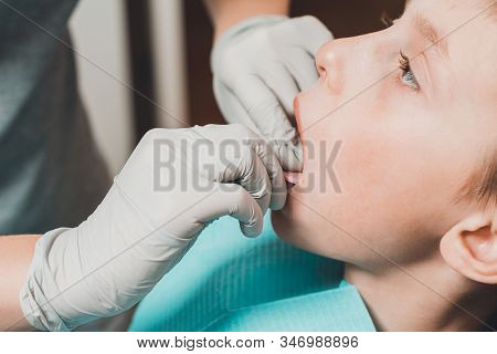 The Boy Orthodontist Makes A Fitting For The Plate.