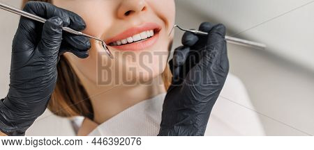 Banner For Dental Theme. Close-up Of Female Smile With White Teeth During Medical Examination. Conce