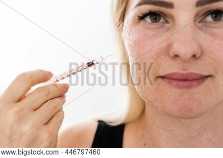 Mesotherapy In The Neck And Chest-neckline. Traces Of Hyaluronic Acid Injections. Light Background