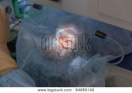 Ophthalmology femto lasik operation