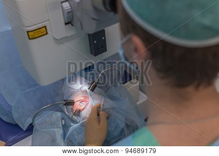 Ophthalmology femto lasik operation
