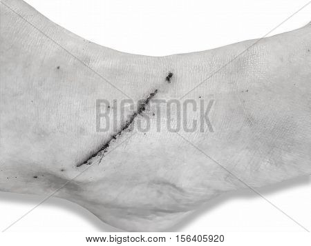 Skin scratch, macro shot of skin scratch, cat scratch, scratch wound, dry wound, injury, wounded foot scar, scared foot.