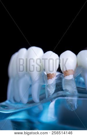 Dentist Dental Teeth Model