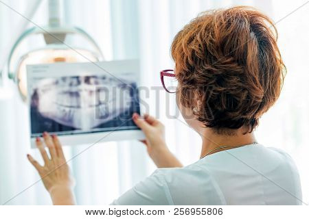 A Dentist Examines Orthopantomogram In Her Hands