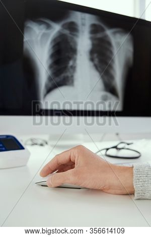 closeup of a young doctor man sitting at his desk checking a chest radiograph in his computer