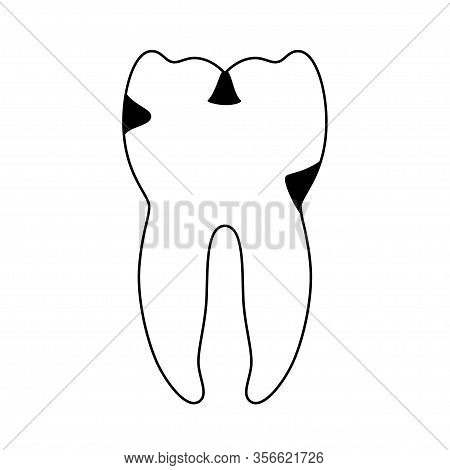 Vector Isolated Illustration Of Tooth With Caries. Types Of Teeth Decay Medical Poster. Banner For D