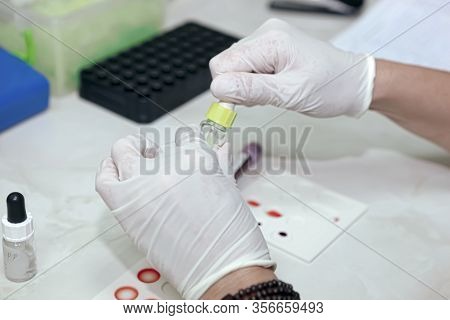 Scientist Working In His Laboratory. A Blood Test Is A Laboratory Analysis Performed On A Blood Samp