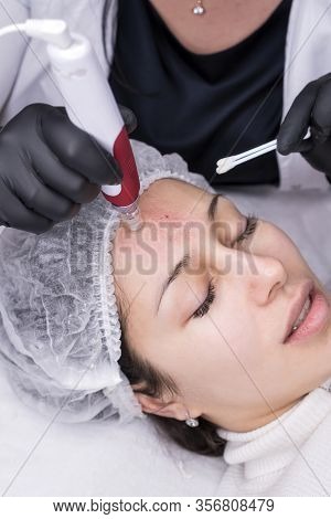 Cosmetologist Making Mesotherapy Injection. Microneedle Mesotherapy. Treatment Woman At Beautician. 