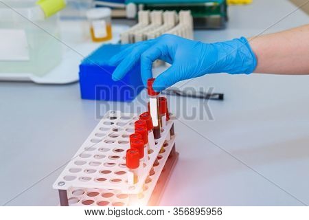 Nurse Arranges Test Tubes With Blood On A Tray. Virus Infection. Pneumonia Testing. Covid-19 And Cor