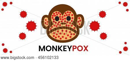 Monkey Pox Virus Global Outbreak Banner Pandemic Disease Spread Awareness And Alert. Monkey Pox Desi
