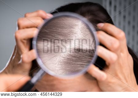 Dermatologist's Hand Examining Woman's Hair With Magnifying Glass