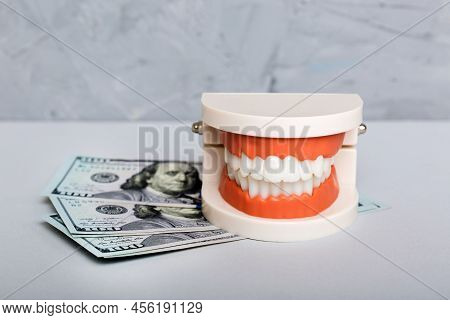 Closeup Model Of A Human Jaw With White Teeth And Dollar Bill. Dentistry Conceptual Photo. Prostheti